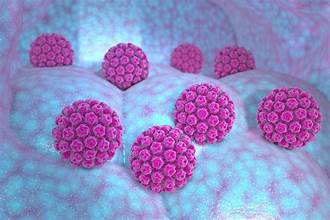 HPV infection