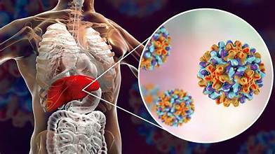 Hepatitis B
