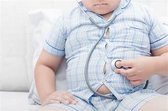 childhood obesity