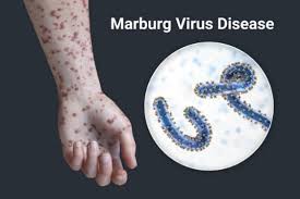 Marburg Virus